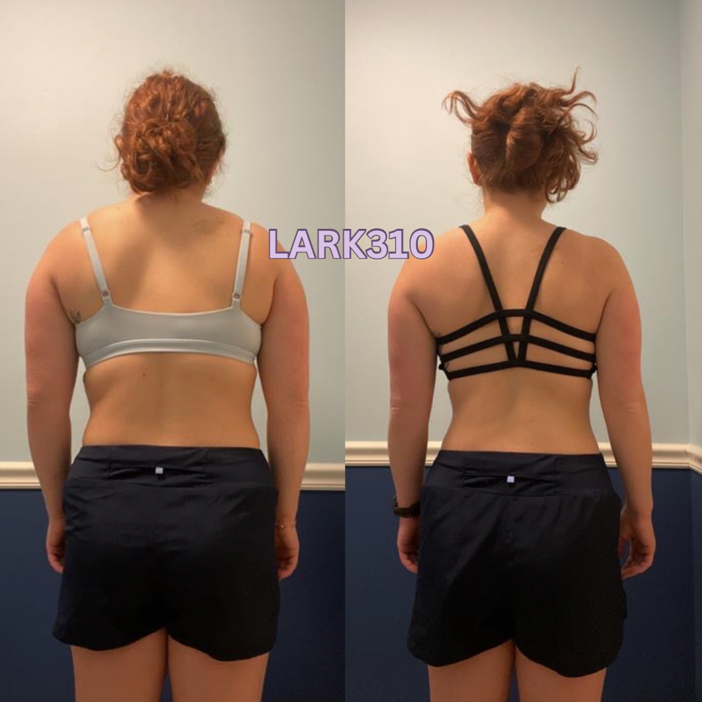 Client before and after, back view — LARK310