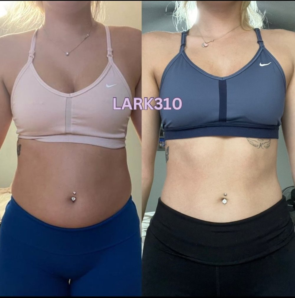 Client before and after, front view with abs — LARK310