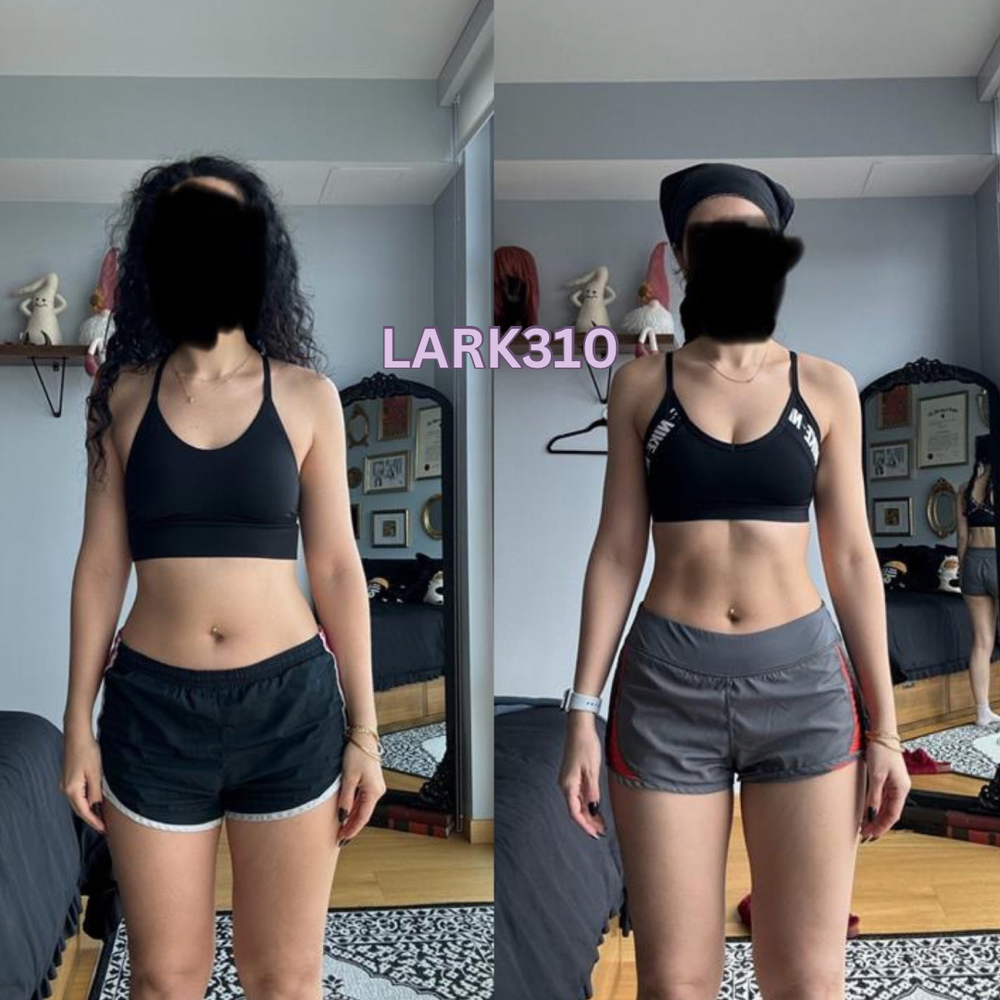Client before and after, front view — 3 months of LARK310