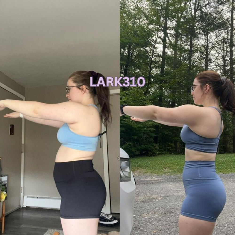 Client before and after, side view — LARK310