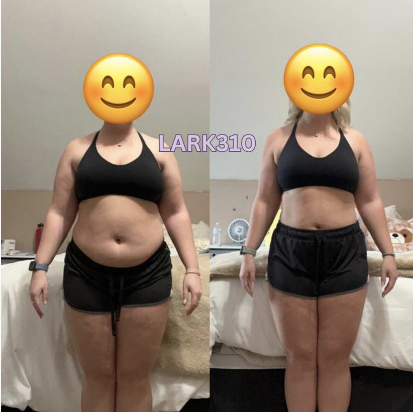 Client before and after, front view — LARK310