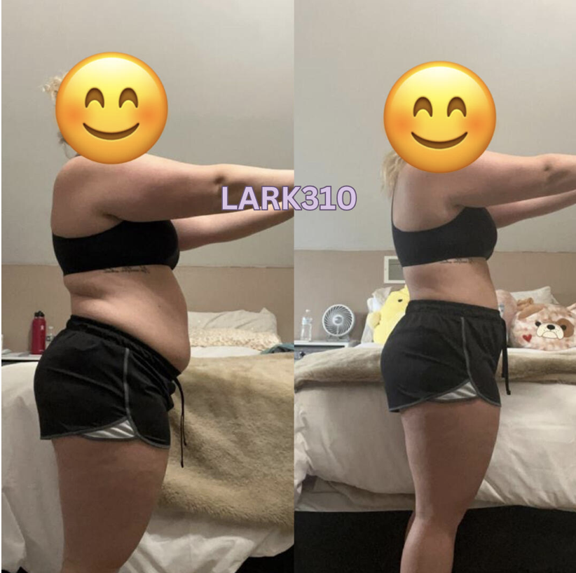 Client before and after, side view — LARK310
